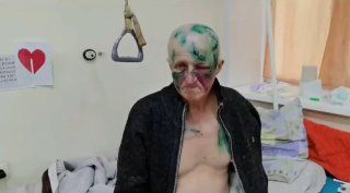 Рыбак выжил после нападения медведицы в Чугуевском районе – отбивался удочкой и кулаками
