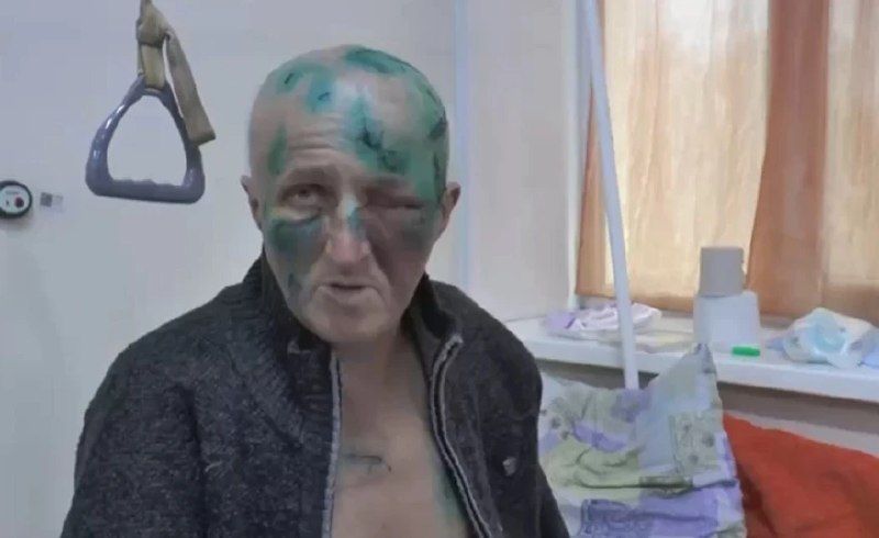 Медведь напал на жителя села Ленино Чугуевского муниципального округа Приморья во время рыбалки — Вести Приморье