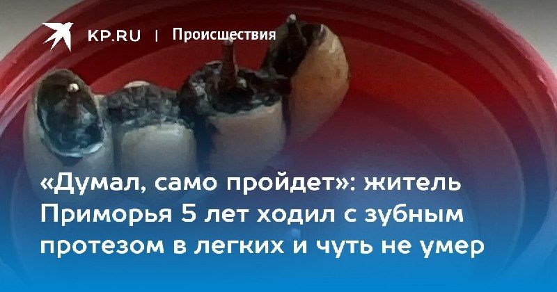 В Приморье 43-летний мужчина пять лет жил с зубным протезом в легких — КП - Владивосток